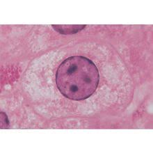 Check spelling or type a new query. Typical Animal And Plant Cells Microscope Slide Student Set Carolina Com