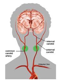 Maybe you would like to learn more about one of these? How Many Carotid Arteries In The Neck Stenting As Good As Surgery Over Long Haul In Treating