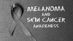 792,495 lives lung and bronchial cancer is the top killer cancer in the united states. Preventing Treating And Surviving Melanoma The Most