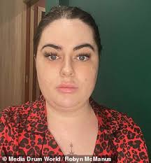 I paid £5,000 for liposuction to tackle my double chin