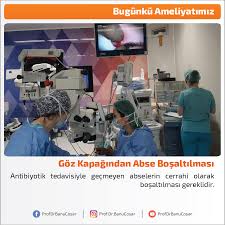 Antibiyotik Tedavisiyle Gecmeyen Abselerin Cerrahi Olarak Bosaltilmasi Gereklidir Gozkapagindanabsebosaltilmasi Gozkapagindaabse Profdrbanucosar Opht Bilgi