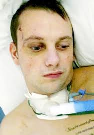 Former Ramsbottom United winger Matthew Edgington quits football following  attack