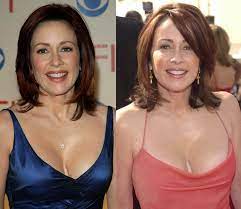 30.05.2018 · in 2015, the vanderpump rules star chose to undergo the plastic surgery operation to reduce her breast size from a ddd to a regular d, which she calls one of … Has Patricia Heaton Had Plastic Surgery Done Before And Af Flickr