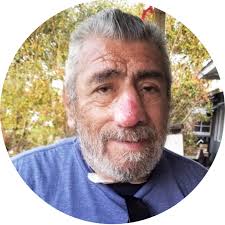 Roger's Story (As seen