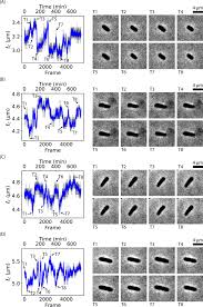 Self diagnosis the device, when a possible functional problem is detected, shows on the display the problem kind and utters the alarm signal. Silver Ions Cause Oscillation Of Bacterial Length Of Escherichia Coli Scientific Reports