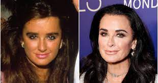 Kyle richards spills some behind the scenes facts on a recent rhobh moment with sister kim. Kyle Richards Transformation Rhobh Star Then And Now