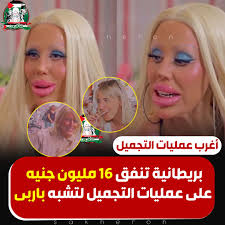 أغرب عمليات التجميل 🚩 بريطانية تنفق 16 مليون جنيه على عمليات التجميل لتشبه  باربي 😒