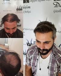 Degisim Sac Ekim Merkezi Agri Home Facebook