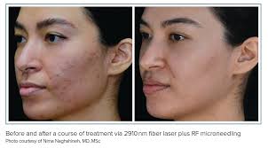 Tried and True Energy-Based Technologies