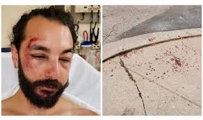 One car stayed on the scene but police are on the. A Hit And Run Scooter Crash Nearly Killed Him Now He S Fighting For The Data That Could Reveal The Rider S Identity The Washington Post