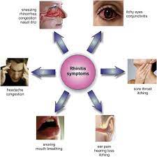 Allergic Rhinitis Asthma Symptoms Asthma Allergic Rhinitis