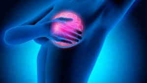 We take a comprehensive approach, evaluating the. Detailed Genetic Study Provides Most Comprehensive Map Of Breast Cancer Risk To Date Ecancer