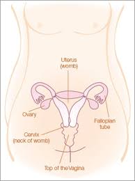When cervical cancer metastasizes to other regions of the body, symptoms may be related to the area to. Cervical Cancer