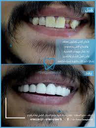 We did not find results for: Dr Esraa Daraghmeh Ø¯ Ø§Ø³Ø±Ø§Ø¡ Ø¯Ø±Ø§ØºÙ…Ø© Home Facebook