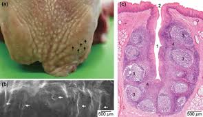 Image result for tonsilla palatina