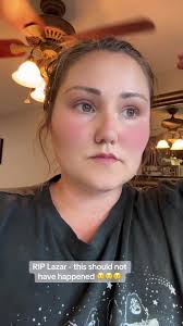 Dave Castro Instagram Story Lazar