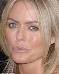 Newly-single Patsy Kensit breaks her silence