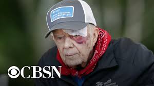 Jimmy carter's accomplishments and policies. Risks Of President Jimmy Carter S Operation For Brain Pressure Youtube