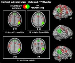 What does rtpj stand for? The Inhibition Of Automatic Imitation A Meta Analysis And Synthesis Of Fmri Studies Biorxiv