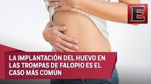 Las Causas Y Sintomas De Un Embarazo Ectopico Youtube