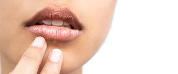 Sonnenbrand Auf Den Lippen Preval Dermatica