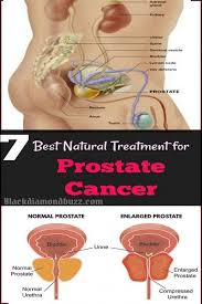 Prostate Cancer Treatment With Home Remedies That Work Health Medizin Gesundheit
