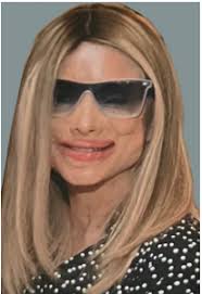 Hear a Burn Survivor's Journey of Care, Communication, Compassion