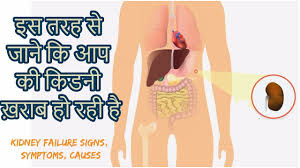 Kidney Damage Hone Ke Lakshan In Hindi Kidney Failure Disease