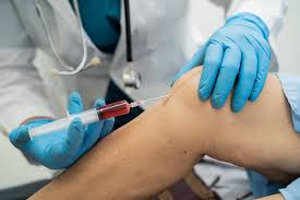 Image result for Knee Joint Injection