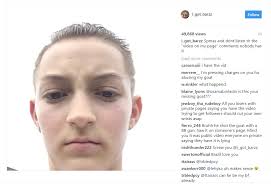 Backpack Kid From Katy Perry S Snl Show Shoots Goat The Blemish