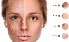 Morning everyone, just arrived and in need of some advice from you lovely  people, can anyone tell me who is and where can i find the "Natural Tone'"  Skincare adviser is for