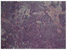 This is the newest place to search, delivering top results from across the web. Mesothelioma With Non Pleural Malignancy A Red Herring Or Just An Uncommon Pairing Journal Of Cardiothoracic Surgery Full Text