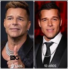 Qué se hizo Ricky Martin para pasar de esto a esto? Primero es importante  reconocer que el cantante no usa Botox, podemos ver su frente y patas de  gallo muy marcadas naturales
