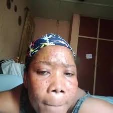 De Luis 100% soap and cream is purely organic super super active product,it  a great product that gives your skin a shiny and beautiful looks.It boost  your confidence without having to break a bank.De ...