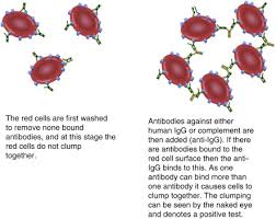 Image result for Direct Coombs