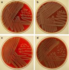 Cultural characteristics of staphylococcus aureus. Human Infections Caused By Staphylococcus Argenteus In Germany Genetic Characterisation And Clinical Implications Of Novel Species Designation Springerlink