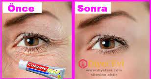 Gozalti Kirisikliklari Icin Dis Macunu Domates Suyu Aloevera Karisimi Wrinkles Homemade Beauty Care Tomato Juice