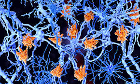 Jun 12, 2020 · there is no cure for multiple sclerosis. Microrna Could Lead To New Methods To Treat Multiple Sclerosis