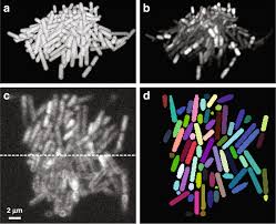 This lets us find the most appropriate writer for any type of assignment. Non Invasive Single Cell Morphometry In Living Bacterial Biofilms Nature Communications