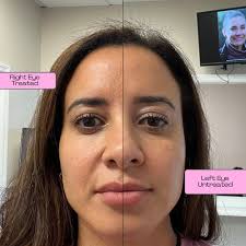 Luz MediSpa 💉 Westchester Beauty & Wellness