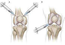 Image result for Injectable Corticosteroid