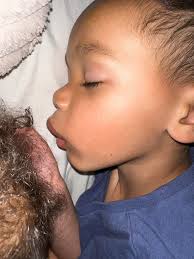 Prayers for a 5-year-old with a knocked-out tooth