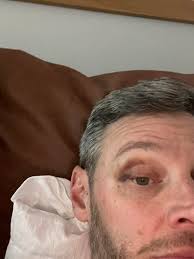 Hello, I'm Cleveland and something to know about me is I have seizures in  my sleep falling down all the time black out all the time