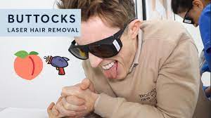The butt cheeks will be hair free for several weeks, expect some skin redness and soar pain in the first hours. Laser Hair Removal On My Butt Men S Laser Review Youtube