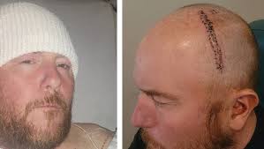 Fundraiser for David Corcoran by Keith Corcoran : Let's Get Dave back