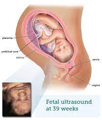 Fetal Ultrasound 9 Months Babycentre Uk
