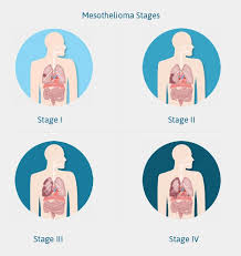 Pin On Health