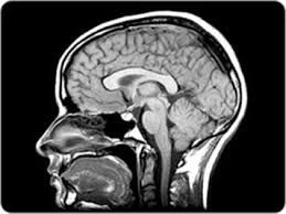 Magnetic Resonance Imaging Mri For Brain Tumours