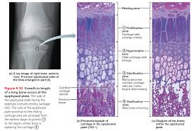 X Ray Image Of A Right Knee Showing The Epiphyseal Plates Of The Articulating Bones And Photomicrograph And Illustration O Epiphyseal Plate X Ray Images X Ray