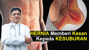 Mulia, seperti dilansir dari pemberitaan. Angin Pasang Hernia Simptom Punca Rawatan
